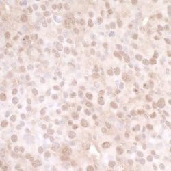 USP13 Antibody, Novus Biologicals 0.1mg; Unlabeled:Antibodies, Polyclonal